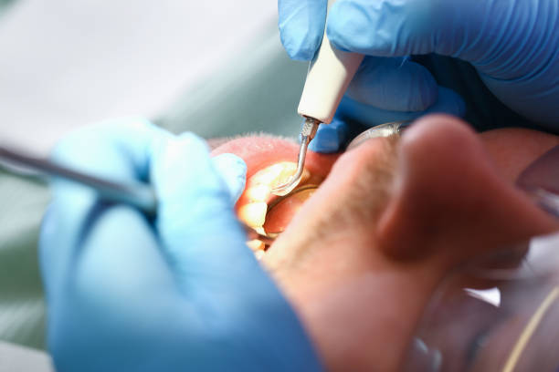 Best Tooth Infection Emergency Dentist  in Jacinto City, TX