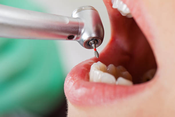 Best Cracked Tooth Emergency Dentist  in Jacinto City, TX